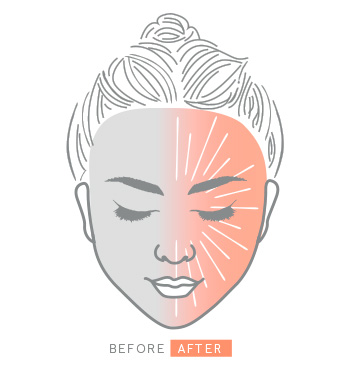 Ein illustriertes Gesicht einer Frau zeigt die vorher und nachher Wirkung bei Anwendung des Clinical Solutions Boosters Ferulic + Niacinamide Brightener.