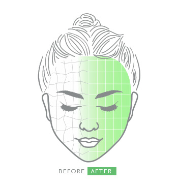 Ein illustriertes Gesicht einer Frau zeigt die vorher und nachher Wirkung bei Anwendung des Clinical Solutions Boosters PHA + AHA Resurfacer.