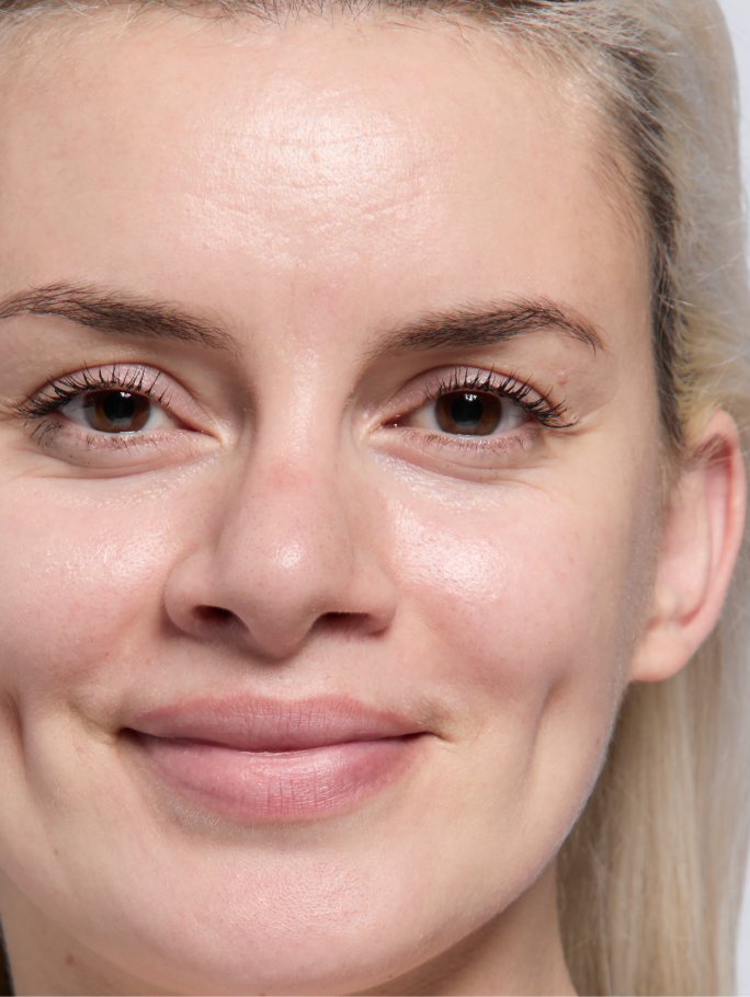 Person mit hellerem Hautton vor dem Auftragen der TimeWise&reg; 3D Foundation.